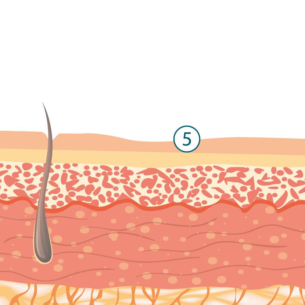 Scar Treatment Mechanism of Action 3rd stage